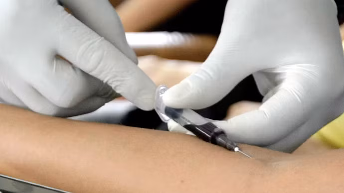 Nils khai rằng cảm thấy buồn chán vì hắn có kỹ năng tuyệt vời trong việc hồi sinh người sắp chết nhưng lại hiếm khi được thực hành. Tên thật của nhân vật này không được tiết lộ. Y tá này đã giết người bằng cách tiêm Gilurytmal, một loại thuốc mà y tá chỉ sử dụng dưới sự giám sát nghiêm ngặt của bác sĩ vào cơ thể bệnh nhân. Tác dụng phụ của thuốc này gồm tim đập nhanh, huyết áp giảm và các cơ tim hoạt động lệch nhau. 