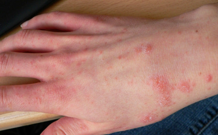 Bên cạnh đó, các loại kem chống nắng, mỹ phẩm giả thường chứa nhiều yếu tố kim loại để tạo độ đẹp cho mỹ phẩm, hay các chất tạo mùi… Đây cũng là những chất dễ gây phản ứng phụ.