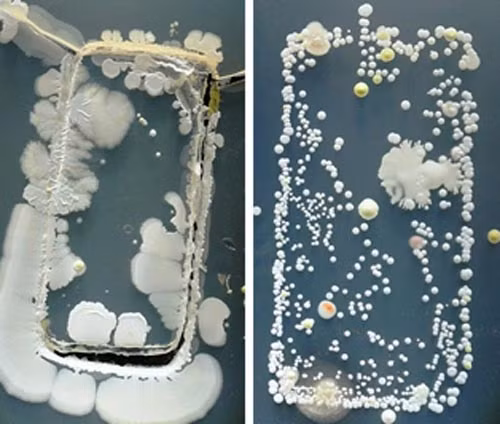 Điện thoại di động khiến mẹ bầu bị bệnh. Điện thoại di động có thể khiến bạn bị ốm vì màn hình điện thoại của bạn chứa rất nhiều vi trùng. Trước khi dùng bữa, bạn thường rửa tay bằng xà phòng khử trùng. Nhưng ngay khi điện thoại sáng lên, bạn sẽ không ngần ngại chạm vào màn hình để kiểm tra thông tin.