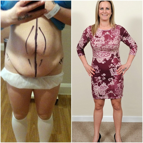 "Dù phải mất nhiều thời gian, công sức và tiền bạc để đạt được sự tự tin khi mặc bikini nhưng tôi không hề cảm thấy hối tiếc. Tôi chưa từng cảm thấy tuyệt vời như vậy kể từ sau khi sinh 3 đứa con", Natalie chia sẻ.