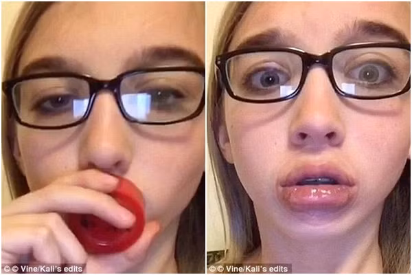 Không chỉ vậy, bạn sẽ phải chịu đau đớn, ngứa rát nếu ăn đồ ăn cay nóng.