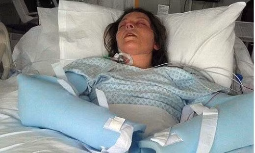 Sốc độc tố. Đây được coi là tai nạn “đặc trưng” có thể xảy ra khi sử dụng tampon. Hội chứng này rất hiếm gặp nhưng có thể gây nguy hiểm tới cả tính mạng. Nguyên nhân dẫn đến điều này là do một số loại độc tố của chủng tụ cầu gây ra và hay gặp ở những bạn để tampon trong âm đạo quá lâu. Khi bị sốc độc tố, các bạn có thể gặp các biểu hiện như nhức đầu, chóng mặt, nôn mửa, sốt cao, đau cơ, đau họng…