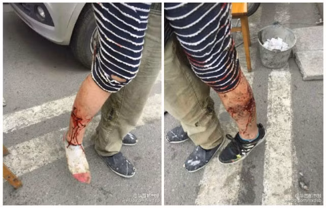 Nguòi mẹ dẻ chó dũ cán xé mình, che chỏ con tho-Hinh-2