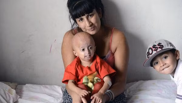 Hầu hết các bệnh nhân của căn bệnh lạ này đều qua đời vì đau tim hoặc đột quỵ trước độ tuổi 13.