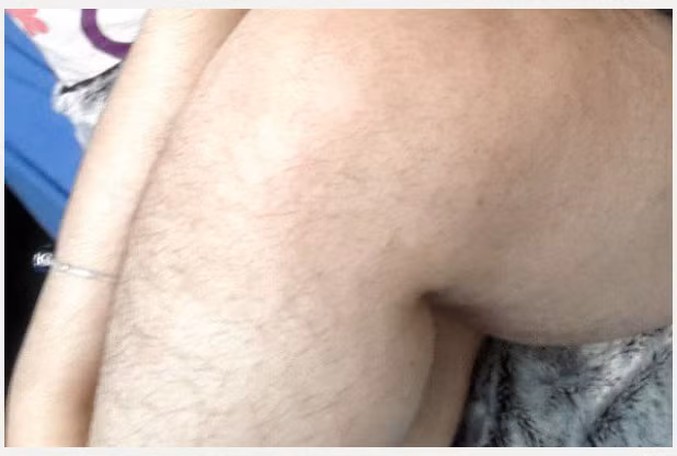 “Đàn ông hay phụ nữ đều có lông trong cơ thể, nhưng những phụ nữ lại bỏ nó đi để thể hiện sự nữ tính. Còn tôi lại nghĩ ngược lại, bạn vẫn đầy nữ tính và quyến rũ ngay cả khi trên người có nhiều lông”, nữ sinh chia sẻ.