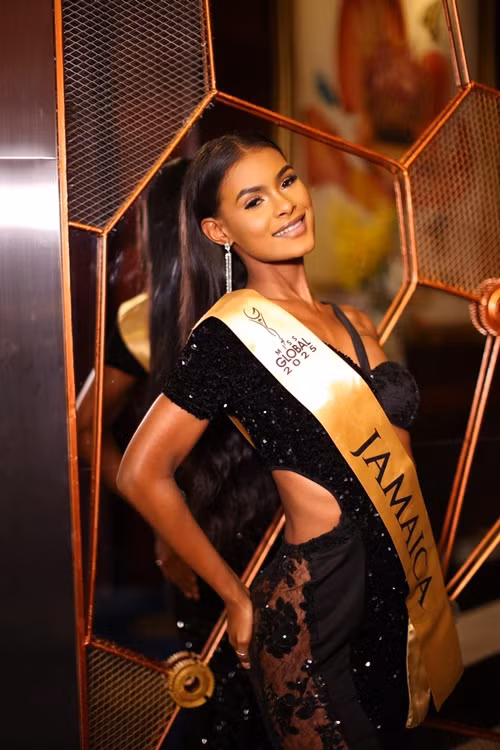 Á hậu 1 Miss Global 2025 Keri-Ann Amanda Greenwood có nụ cười cuốn hút, thân hình gợi cảm.