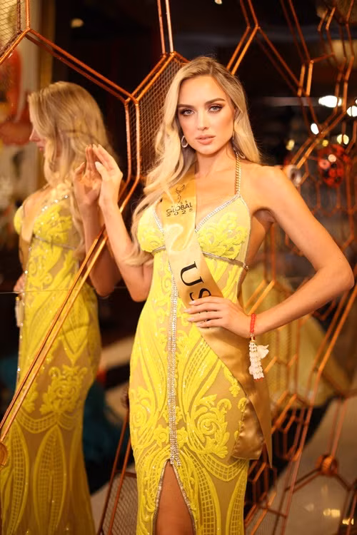 Lindsay Lauren Becker - Á hậu 3 Miss Global 2025 đẹp như búp bê sống.