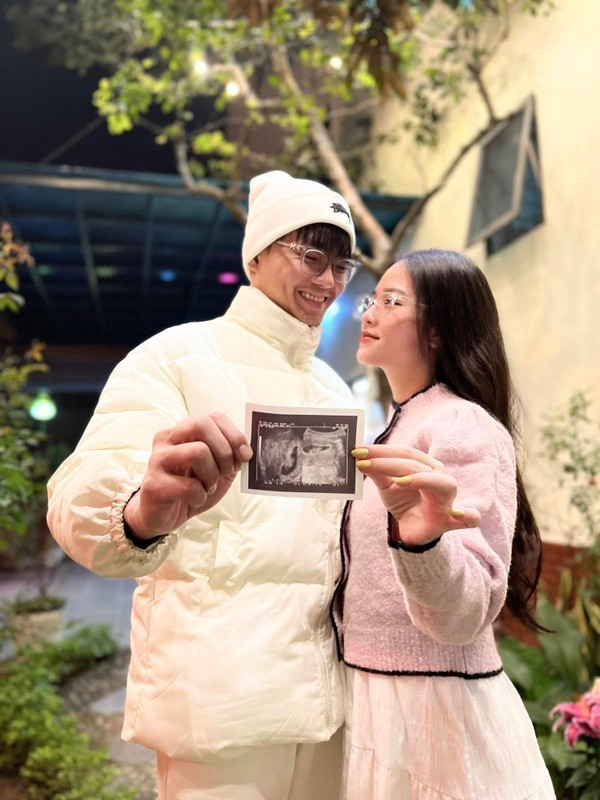 Sau khi kết hôn, vợ chồng Huyền My trở nên thoải mái hơn trong việc chia sẻ về cuộc sống đời tư, cả hai thường xuyên có những chuyến du lịch ngọt ngào bên nhau.