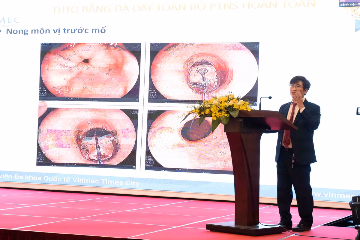 Vinmec to chuc hoi nghi “tien bo trong phau thuat noi soi dieu tri ung thu thuc quan“-Hinh-2