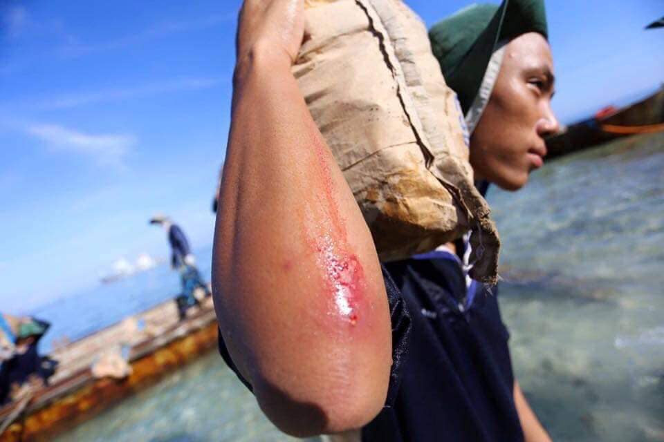 Giữa bốn bề là sóng biển và gió mặn, các loại máy móc được huy động tới đây đều chịu thua điều kiện tự nhiên. Chỉ có sức người là có thể khuất phục được biển khơi. Nguồn ảnh: TTTDHCM.