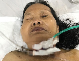 Phu chau mo ga, ba noi truot chan bi dao dam xuyen co