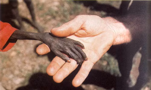 Nhiếp ảnh gia Mike Wells chụp cánh tay cậu bé chết đói đặt trên bàn tay của một nhà truyền giáo ở Uganda năm 1980. Vào thập niên 80 của thế kỷ 20, kết quả điều tra cho thấy cứ 5 người Uganda thì một người chết đói.