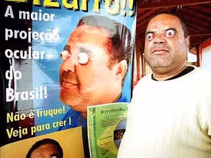 Claudio Pinto ở Brazil nổi tiếng với khả năng làm lồi cặp mắt ra ngoài hốc mắt 4 cm. Với khả năng đặc biệt này, Pinto đã có những buổi diễn trước hàng ngàn khán giả để kiếm thu nhập.