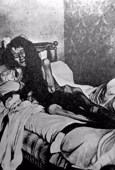 Cô gái Mademoiselle Blanche Monnier gầy trơ xương, bị mẹ đẻ nhốt trong nhà suốt 25 năm. Cô được cảnh sát giải cứu vào 23/5/1901 tại Paris, Pháp.