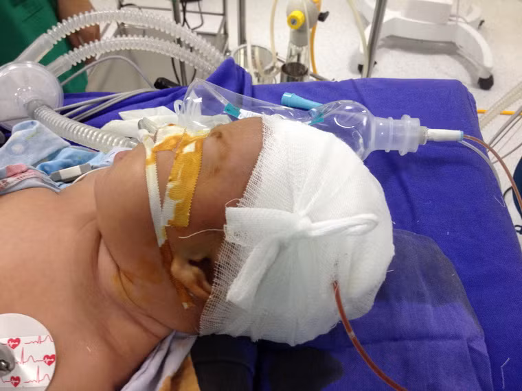 Hồi sức sau mổ.