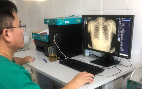 4. Ứng dụng trí tuệ nhân tạo trong phòng, chống đại dịch COVID-19. Trong năm 2021, Việt Nam ứng dụng công nghệ xử lý dữ liệu lớn và trí tuệ nhân tạo (AI), mô hình hóa hiện trạng dịch bệnh để đánh giá rủi ro, phát hiện các cụm dịch tiềm năng...