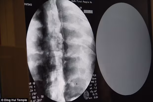 Theo các chuyên gia, xương hàm trên, hàm dưới, xương sườn, cột sống và tất cả khớp của nhà sư Từ Hiền đều hoàn chỉnh. Điều này khiến giới khoa học cảm thấy bất ngờ và khó tin.