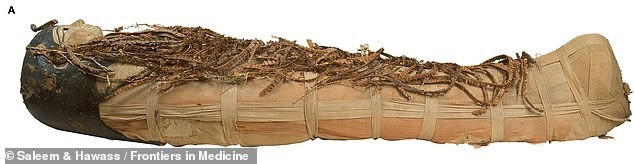 Tuy nhiên, họ tìm thấy nhiều chấn thương trên xác ướp sau khi được chôn cất. Họ hoài nghi những chấn thương này có thể do những kẻ trộm mộ thời xưa gây ra.