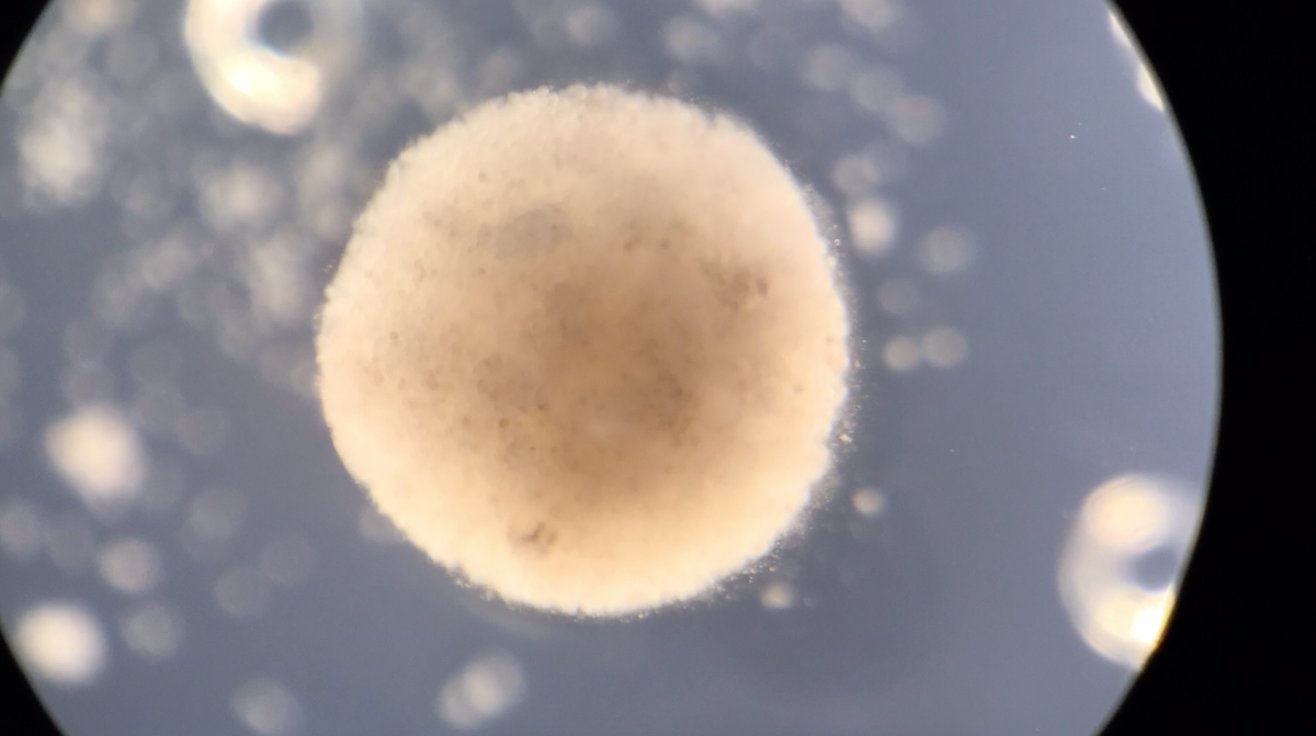 Từ đây, các chuyên gia nhận định sự kết hợp giữa sinh học phân tử, xenobot và trí tuệ nhân tạo có thể được sử dụng trong tương lai khi giải quyết các vấn đề về môi trường như thu thập vi nhựa trong đại dương, kiểm tra hệ thống rễ hay y học tái tạo.