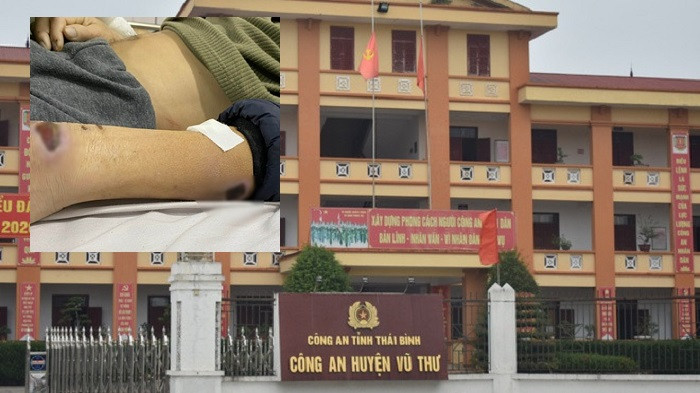 Cựu Đội trưởng, đội phó Công an Vũ Thư bị bắt: “Dùng nhục hình” thế nào? Cuu Doi truong, doi pho Cong an Vu Thu bi bat: “Dung nhuc hinh” the nao?