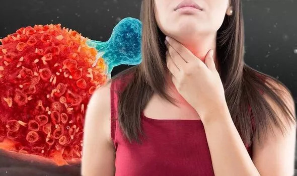 Canh bao trieu chung dau tien cua ung thu thuc quan