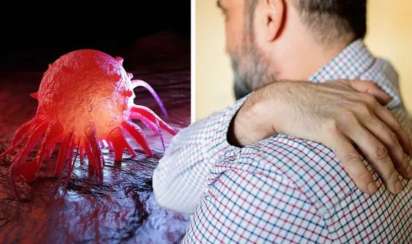 Phat hien ung thu sau con dau vai keo dai