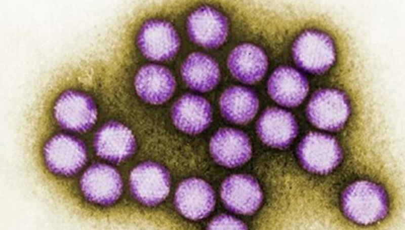 Theo các thông tin lưu trữ từ Cục Y tế dự phòng, Bộ Y tế, tại Việt Nam, bệnh do virus Adeno lưu hành rộng rãi ở nhiều nơi trong cả nước. Bệnh thường xảy ra tản phát trong suốt năm, có năm xảy ra dịch và tần số mắc bệnh thường tập trung vào những tháng Xuân - Hè nên rất dễ nhầm lẫn với bệnh viêm đường hô hấp cấp do virus khác vào mùa Xuân hoặc với bệnh sốt dengue vào đầu mùa Hè. Ảnh: CDC.