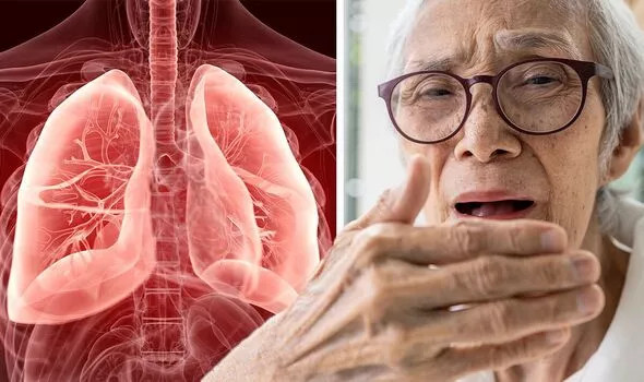 Trieu chung nhiem trung phoi it nguoi de y