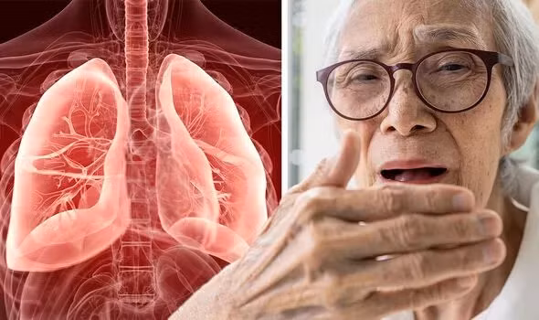 Trieu chung nhiem trung phoi it nguoi de y