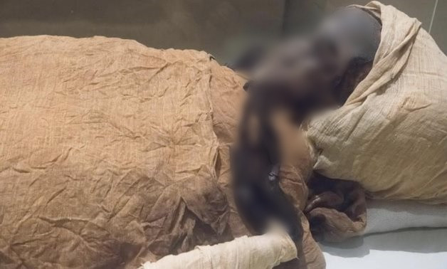 Vào năm 1881, xác ướp pharaoh Ai Cập Seqenenre Tao II được phát hiện tại Deir el-Bahari. Thi hài ông hoàng này được giám định bằng thiết bị X quang trong những năm 1960.