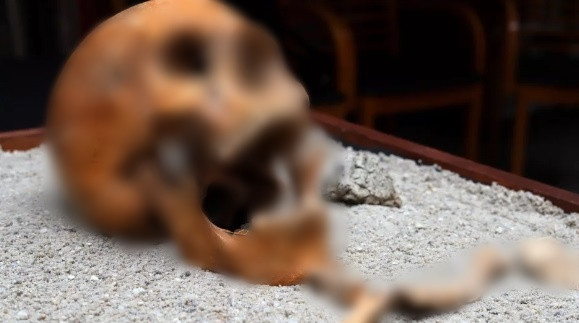 Trong cuộc khai quật gần thành phố Jászberény, thuộc vùng Jászsá, cách thủ đô Budapest của Hungary khoảng 55 km về phía đông, các nhà khảo cổ tìm thấy một ngôi mộ của bác sĩ La Mã cổ đại.