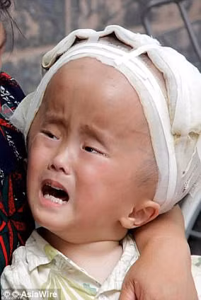 Cha mẹ quyết phẫu thuật cho con dù bác sĩ lắc đầu - Hình 2 Cha me quyet phau thuat cho con du bac si lac dau-Hinh-2