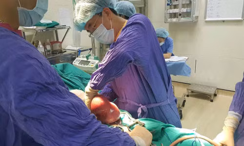 Tuong beo bung, hoa ra dang mang 20 u mo