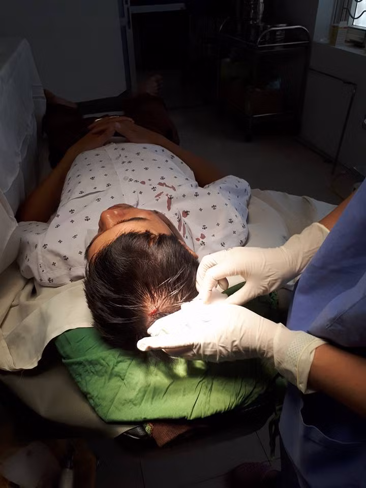 Mau lai do tren dau thay thuoc