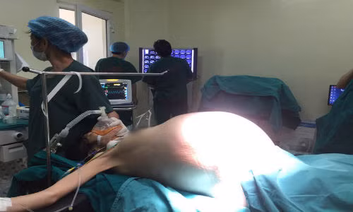 Khoi u khong lo 16kg khien co gai tre nhu mang bau 9 thang