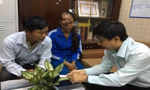 Tim lai nu cuoi cho co gai 21 nam mang buou mau tren mat