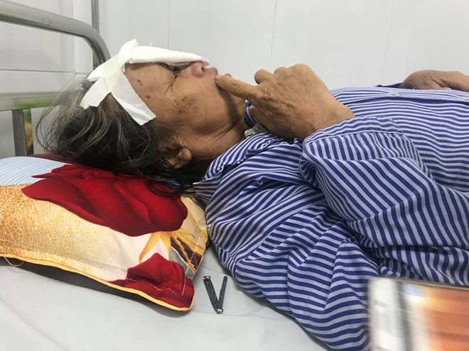 Not den bat thuong tren da ‘to’ can benh khong ai ngo toi