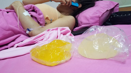 Ca si Ivy Tran gap “su co”: Nan nhan to bac si vo trach nhiem (!?)-Hinh-2