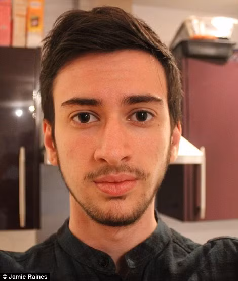 Jamie Raines, 21 tuổi cho hay hành trình chuyển giới của anh trải qua 3 năm ròng rã chăm chỉ uống thuốc. Ban đầu anh chỉ định uống thuốc testosterone trong vòng một năm. Tuy nhiên, khi nhận ra mình ngày một khác biệt, Raines quyết định uống thêm hai năm nữa.