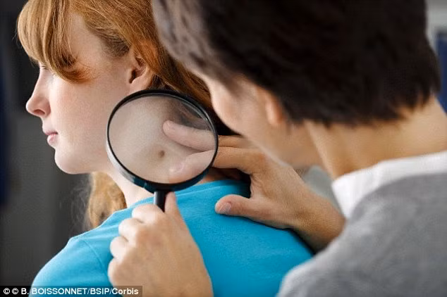 Nốt ruồi thay đổi hình dạng. Nốt ruồi thay đổi màu sắc hoặc kích thước cũng cần được sàng lọc y tế ngay lập tức.