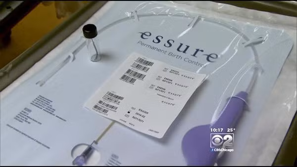 Hồi tháng 11/2014, nhiều phụ nữ sử dụng biện pháp tránh thai này phản ánh Essure gây đau khớp, mệt mỏi mãn tính, tăng cân, chu kỳ kinh nguyệt nhiều bất thường, đau đầu, suy nhược cơ thể.