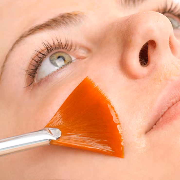 Điều trị retinol và chất chống oxy hóa. Nhiều nghiên cứu đã chứng minh retinol - một chất dẫn xuất của vitamin A phát huy tác dụng hiệu quả cao trong việc điều trị nếp nhăn và trẻ hóa làn da.