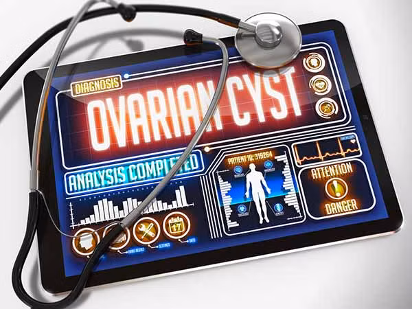 Có 2 loại u nang buồng trứng thường gặp, đó là u nang cơ năng, và u nang thực thể. Loại thứ nhất u nang cơ năng chỉ trường hợp những nang nhỏ ở 2 bên buồng trứng do rối loạn chức năng của buồng trứng gây ra, nó có thể tự mất đi sau một thời gian mà không cần bất cứ phương pháp điều trị nào. Loại thứ 2 là u nang thực thể: phát triển từ các tổn thương thực thể ở buồng trứng.