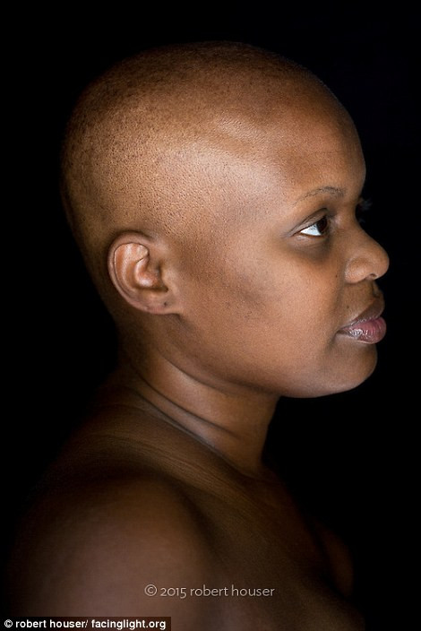 Dự án này được bắt đầu 1 năm trước khi, mỗi bức ảnh phản ánh một tâm trạng riêng của từng bệnh nhân.