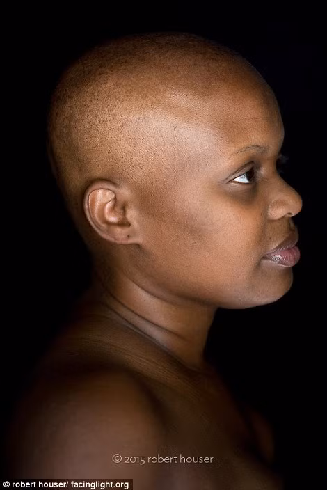 Dự án này được bắt đầu 1 năm trước khi, mỗi bức ảnh phản ánh một tâm trạng riêng của từng bệnh nhân.