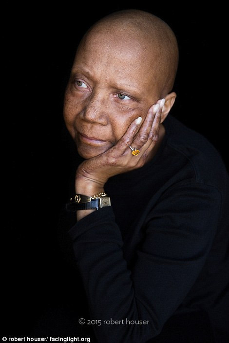 Để thực hiện dự án này, nhiếp ảnh gia phải tìm kiếm các đối tượng bị ung thư thông qua ban truyền thông địa phương và nhiều nhóm từ thiện.