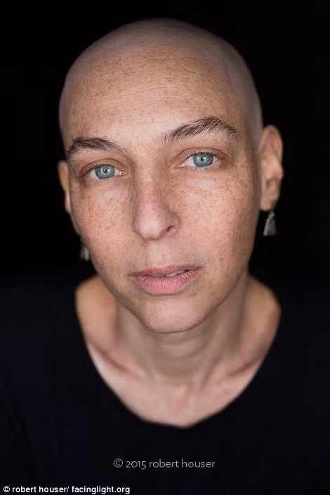 "Một số người cố gắng mạnh mẽ khi đang mệt mỏi do tác dụng phụ của hóa trị. Một số người rơi nước mắt dễ dàng...nhưng tất cả đều có ánh mắt khá lạc quan", nhiếp ảnh gia chia sẻ.