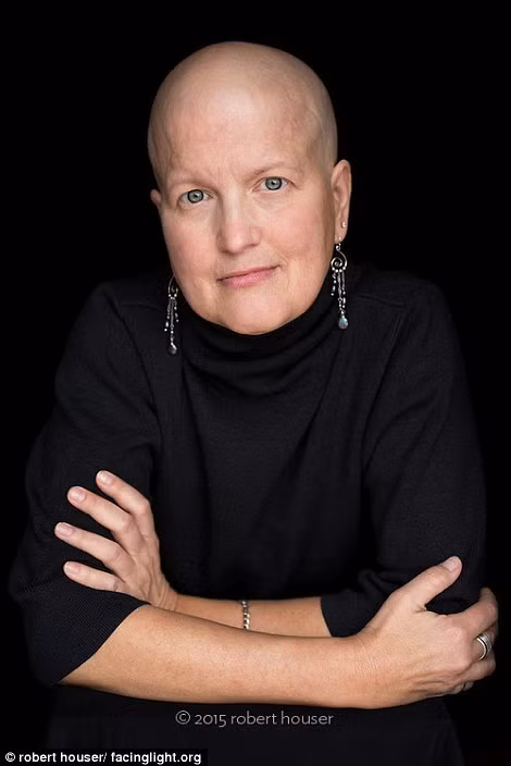 Nhiếp ảnh gia hy vọng rằng những bức ảnh này sẽ truyền cảm hứng cho sự đồng cảm của mọi người với những bệnh nhân đang trải qua hóa trị vì ung thư.