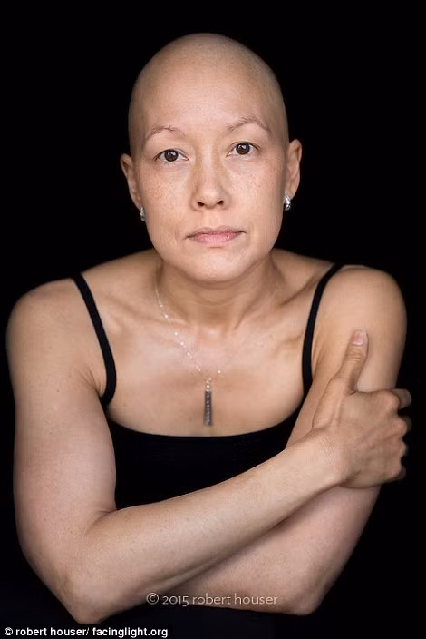 Những bệnh nhân rụng tóc do hóa trị ung thư không hề mất đi nét đẹp