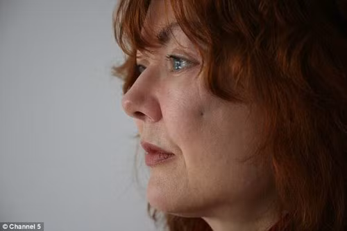 Cô Alex Laird (53 tuổi) đến từ Ai Len là một trong những nạn nhân của phương pháp tiêm chất làm đầy. 8 năm trước cô đã có một quyết định để lại hậu quả nghiêm trọng, đó là việc tiêm chất làm đầy filler vào mặt để trông xinh đẹp, tươi tỉnh và phúc hậu hơn.